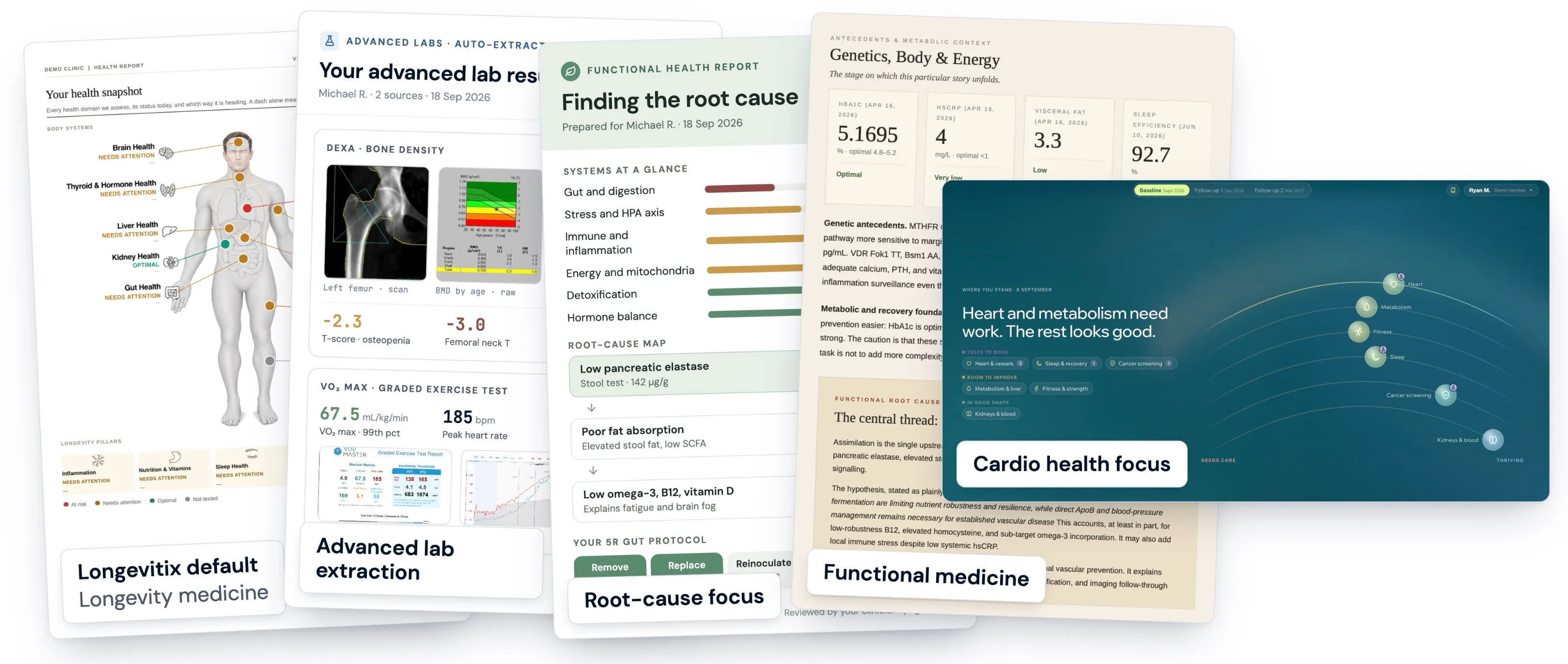 Longevitix default patient report next to clinic-branded report designs: lab-focused, metabolic context and a cardio health dashboard